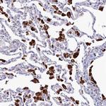 SPNS1 Antibody in Immunohistochemistry (Paraffin) (IHC (P))