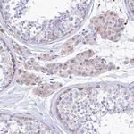 SPNS1 Antibody in Immunohistochemistry (Paraffin) (IHC (P))