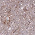 P2X7 Antibody in Immunohistochemistry (IHC)