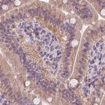 HAAO Antibody in Immunohistochemistry (IHC)