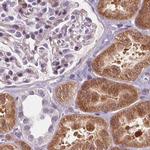 HAAO Antibody in Immunohistochemistry (IHC)