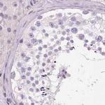 HAAO Antibody in Immunohistochemistry (IHC)