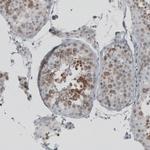 C15orf23 Antibody in Immunohistochemistry (IHC)