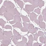 IQCB1 Antibody in Immunohistochemistry (Paraffin) (IHC (P))