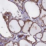 CHMP2A Antibody in Immunohistochemistry (IHC)