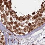 NAE1 Antibody in Immunohistochemistry (IHC)