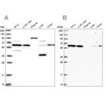 NAE1 Antibody in Western Blot (WB)