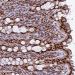 FAM118B Antibody in Immunohistochemistry (Paraffin) (IHC (P))