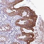 QSOX1 Antibody in Immunohistochemistry (Paraffin) (IHC (P))