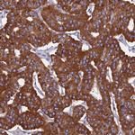 HSD17B8 Antibody in Immunohistochemistry (IHC)