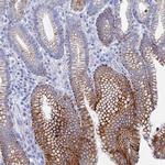 DHX34 Antibody in Immunohistochemistry (Paraffin) (IHC (P))