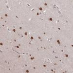 RBM4 Antibody in Immunohistochemistry (Paraffin) (IHC (P))