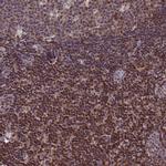 CIAPIN1 Antibody in Immunohistochemistry (Paraffin) (IHC (P))