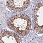 CIAPIN1 Antibody in Immunohistochemistry (Paraffin) (IHC (P))