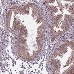 F1A alpha Antibody in Immunohistochemistry (Paraffin) (IHC (P))