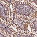 F1A alpha Antibody in Immunohistochemistry (Paraffin) (IHC (P))