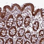 RPUSD2 Antibody in Immunohistochemistry (IHC)