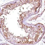 FUZ Antibody in Immunohistochemistry (IHC)