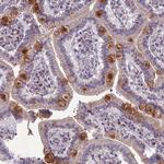 B9D2 Antibody in Immunohistochemistry (Paraffin) (IHC (P))