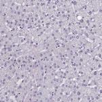 B9D2 Antibody in Immunohistochemistry (Paraffin) (IHC (P))