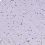 B9D2 Antibody in Immunohistochemistry (Paraffin) (IHC (P))