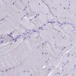 B9D2 Antibody in Immunohistochemistry (IHC)