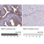 B9D2 Antibody