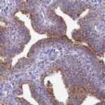 B9D2 Antibody in Immunohistochemistry (IHC)