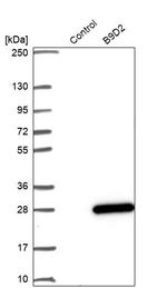 B9D2 Antibody in Western Blot (WB)