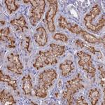 SLC2A6 Antibody in Immunohistochemistry (Paraffin) (IHC (P))