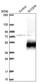 SLC2A6 Antibody in Western Blot (WB)