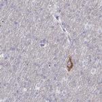 CALY Antibody in Immunohistochemistry (IHC)