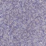 CALY Antibody in Immunohistochemistry (IHC)