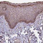 EDAR Antibody in Immunohistochemistry (Paraffin) (IHC (P))