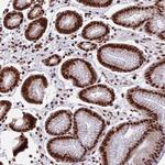 CENPE Antibody in Immunohistochemistry (Paraffin) (IHC (P))