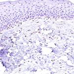 ACAA2 Antibody in Immunohistochemistry (Paraffin) (IHC (P))