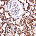 ACAA2 Antibody in Immunohistochemistry (Paraffin) (IHC (P))