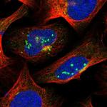 SUR1 Antibody in Immunocytochemistry (ICC/IF)