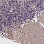 SUR1 Antibody in Immunohistochemistry (IHC)