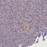 SUR1 Antibody in Immunohistochemistry (IHC)