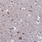 SUR1 Antibody in Immunohistochemistry (IHC)