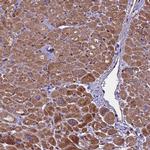 SMCR7 Antibody in Immunohistochemistry (IHC)