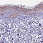 SMCR7 Antibody in Immunohistochemistry (IHC)