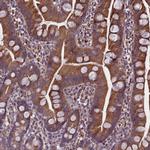 SMCR7 Antibody in Immunohistochemistry (IHC)