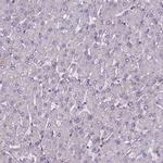 SMCR7 Antibody in Immunohistochemistry (IHC)