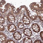 ELOVL6 Antibody in Immunohistochemistry (Paraffin) (IHC (P))