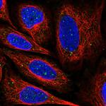 NNT1 Antibody in Immunocytochemistry (ICC/IF)