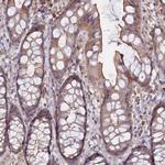 NNT1 Antibody in Immunohistochemistry (Paraffin) (IHC (P))