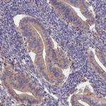 NNT1 Antibody in Immunohistochemistry (Paraffin) (IHC (P))