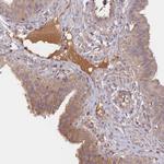 NNT1 Antibody in Immunohistochemistry (Paraffin) (IHC (P))